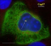 Eine menschliche Zelle im Immunfluoreszenz-Mikroskop