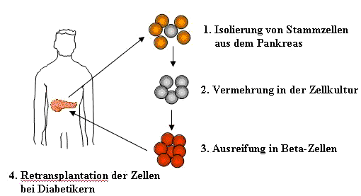 Schematische Darstellung der Herstellung von Betazellen aus adulten Stammzellen