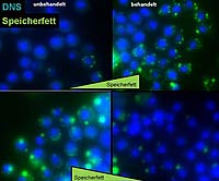 Drosophila-Zellen, in denen die DNA blau und Speicherfette grün gefärbt sind