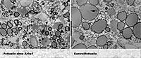 Fettzellen ohne und mit ARFRP1-Protein