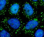 Der regulatorische Proteinkomplex mTORC1