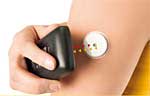 Flash Glucose Monitoring mit dem FreeStyle Libre