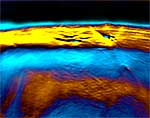 So stellt die neue Lasermethode MSOT das Braune Fett dar. So stellt die neue Lasermethode MSOT das Braune Fett dar.