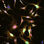 Hypothalamische Neuronen in Zellkultur