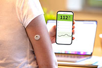 Einige Privatpatienten profitieren jetzt auch von der kontinuierlichen Glukosemessung bei Diabetes mellitus.